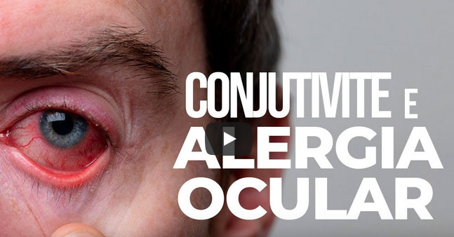 Conjutivite e Alergia Ocular